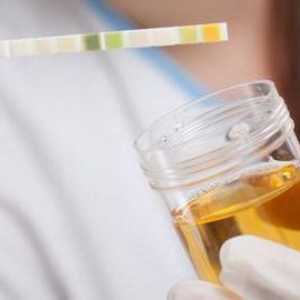 Биохимия на урината: правила за събиране и показатели на нормата