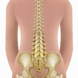 Страничните извивки на гръбнака се наричат ​​... Причини за кривината на гръбначния стълб