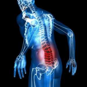 Болка в сакралния гръбнак на жените: причини, диагноза, лечение