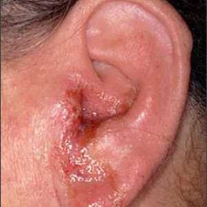 Болести на ухото на хората: симптоми и лечение