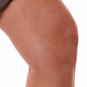 Какво се характеризира с лечението на синовита на колянната става?