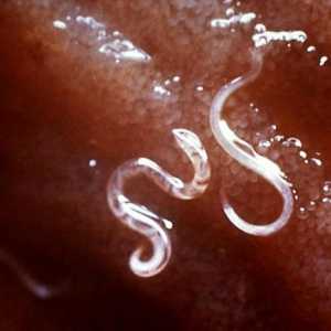 Червеите в човека. Кръгли червеи-паразити: лечение и профилактика