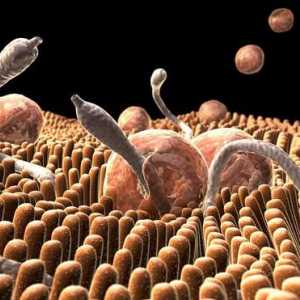 Червеи в човешкото тяло: признаци и източници на инфекция