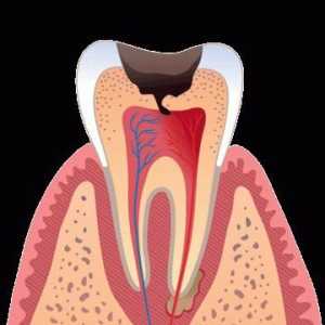 Какво ще стане, ако зъбът боли, когато го докосна?