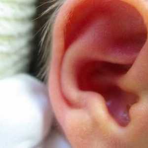 Какво да направите, ако ушите: причини за дискомфорт и начини за отстраняването му
