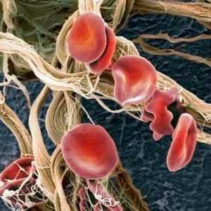 Какво означават повишените кръвни клетки в кръвта, каква трябва да бъде тяхната норма?