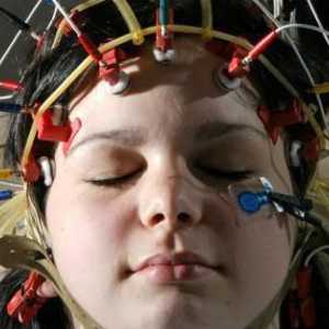 Какво показва електроенцефалограмата на мозъка? Процедура, описание, цел и обратна връзка