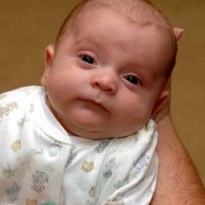 Какво представлява анемията при новородено?
