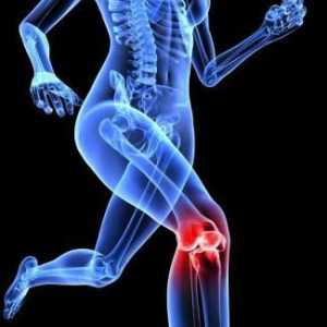Какво представлява деформираната артроза на колянната става?