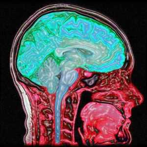Каква е диагнозата на ЯМР? Възможности за MRI-диагностика. Диагностика на ЯМР на мозъка. Отзиви за…