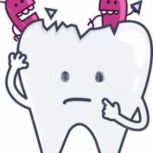 Какво е запечатването на зъбите? Запечатване на зъби при деца
