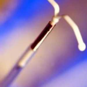 Какво представляват контрацептивните спирали?