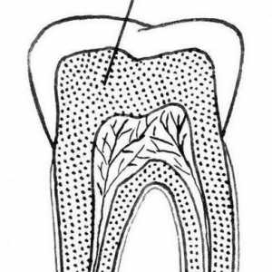 Dentin - какво е това? Видове, структура, състав и характеристики на лечението