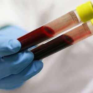 Диагностика на заболяванията. Биохимичен кръвен тест: какво ще покаже?