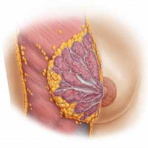 Дисрормални заболявания на млечните жлези: списък, причини, диагностика и методи на лечение