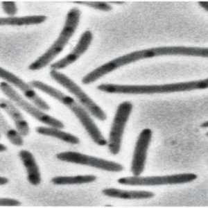 Бактериалната клетка се характеризира с наличието на какво? Характеристики, структура и функции на…