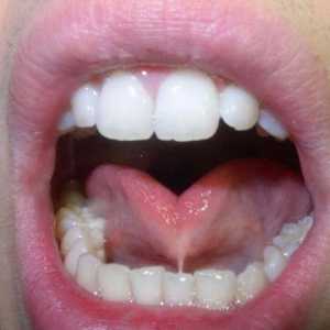 Дъното на устната кухина (анатомия). Устна кухина: структура, физиология
