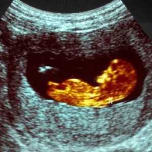 Фетометрия на фетуса за седмици. Фетален размер за седмици