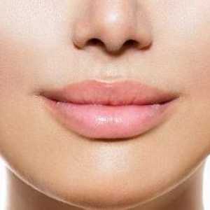 Пълнители на устните. Уголемяване на устните с пълнеж: характеристики на процедурата,…