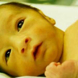 Физиологична жълтеница на новородено: причини, симптоми и методи на лечение