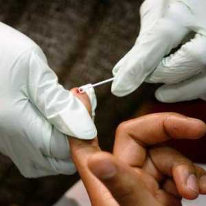 Къде и как да направите тестовете за ХИВ анонимно