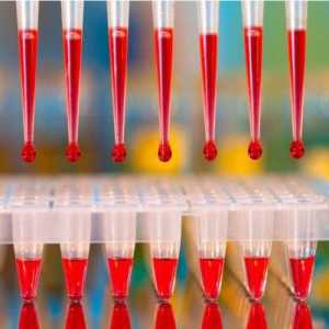 Хемоглобин в кръвния тест: обозначение. Обяснение на кръвния тест