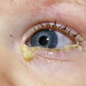 Поглъщащото око на новороденото е повод за безпокойство?