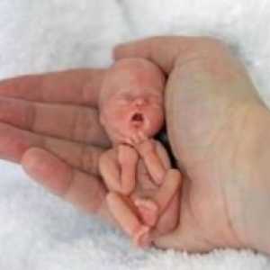 Хирургичен аборт: струва ли му се?