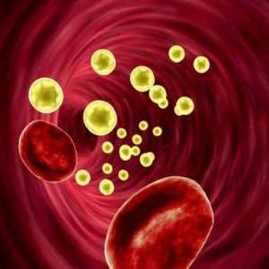 Холестеролът в кръвта: норма за жените и мъжете