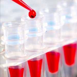 Как да се подготвим за биохимичен кръвен тест? Как е подготовката за доставяне на кръв за…