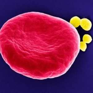 Как се третират Staphylococcus чрез популярни методи
