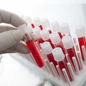 Как се посочват белите кръвни клетки в кръвния тест и какви са техните норми?