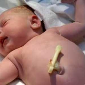 Как да обработим пъпа на новородено правилно и последователно