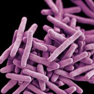 Как се диагностицира туберкулозата в началния етап?