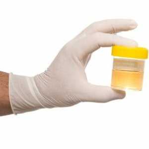 Как правилно да премине анализ на урината в лабораторията