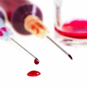 Как да правим правилно кръвта на хормоните?