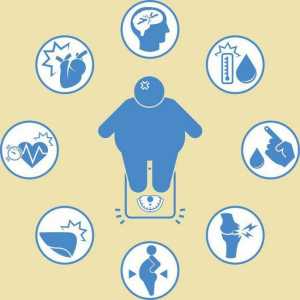 Класификация на затлъстяването. Причини, симптоми, диагноза и лечение на затлъстяването