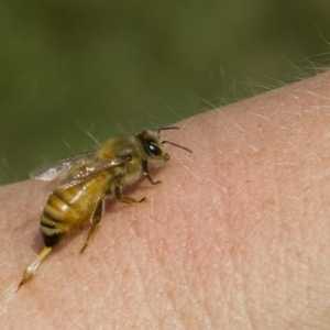 Консултация с специалист: какво да направите, ако пчела е ухапан