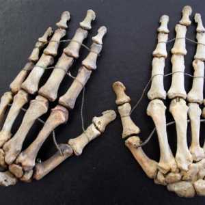 Кости на ръцете: имена и функции. Какво да направя, ако болката от костите боли