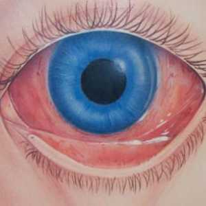 Протеини на червени очи: причини, ефекти и методи на лечение. Защо са червените катерици в дете или…