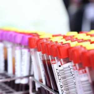Кръвта върху HCG - какво е то, кога да вземете, резултатите