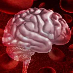 Хеморагии в мозъка: симптоми, лечение, последствия, прогноза