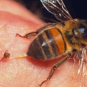 Лечение на варикозни пчели - рецензии. Апитерапия за разширени вени