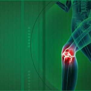 Медицинска артроза на колянната става: как да избера?