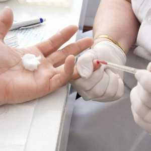 Медицински въпроси: какво трябва да знаете за теста и защо да вземате кръвта от пръстена?