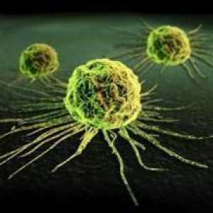 Методи за откриване на ракови клетки в човешкото тяло