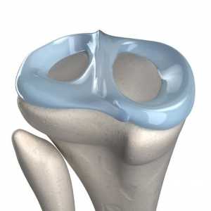 Калъфче за коляно: вид наранявания, лечение