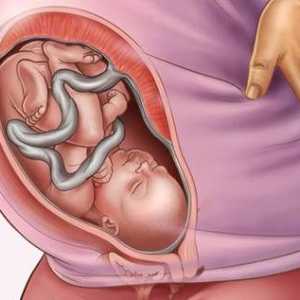 Полихидрамниои по време на бременност: причини, лечение, възможни последици за детето