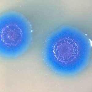 Mycoplasma genitalium: какво е това? Колко опасна е инфекцията?