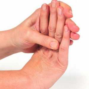 Ръце на Немет: причини и подходящо лечение